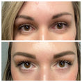 Load image into Gallery viewer, AnteAGE® Eye (15ml)
