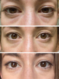 Load image into Gallery viewer, AnteAGE® Eye (15ml)
