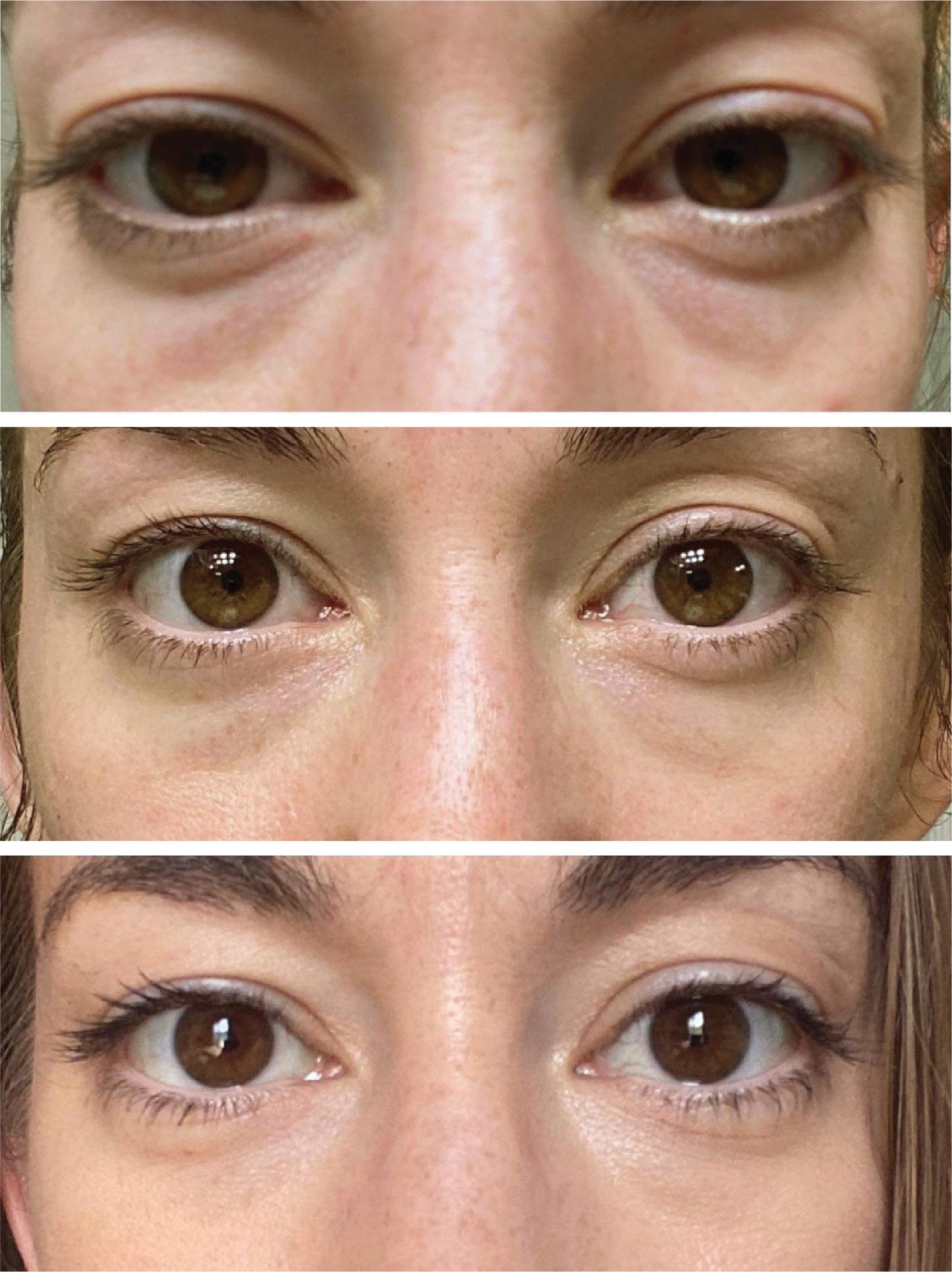AnteAGE® Eye (15ml)
