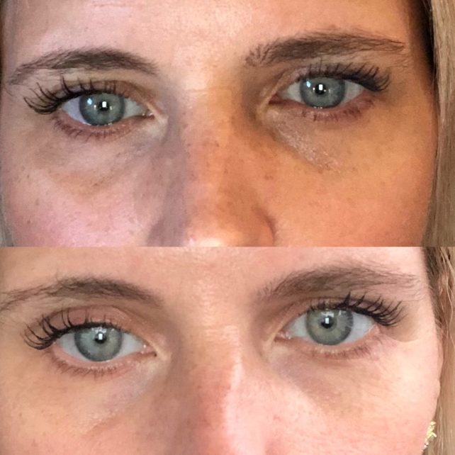 AnteAGE® Eye (15ml)